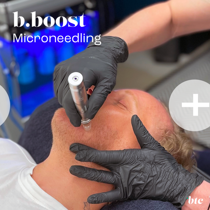 The BTC Boost facial ⚡️ (hydrafacial+microneedling/PRX-T33+LED)