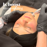 Big Booster (PRX-T33+microneedling+LED)